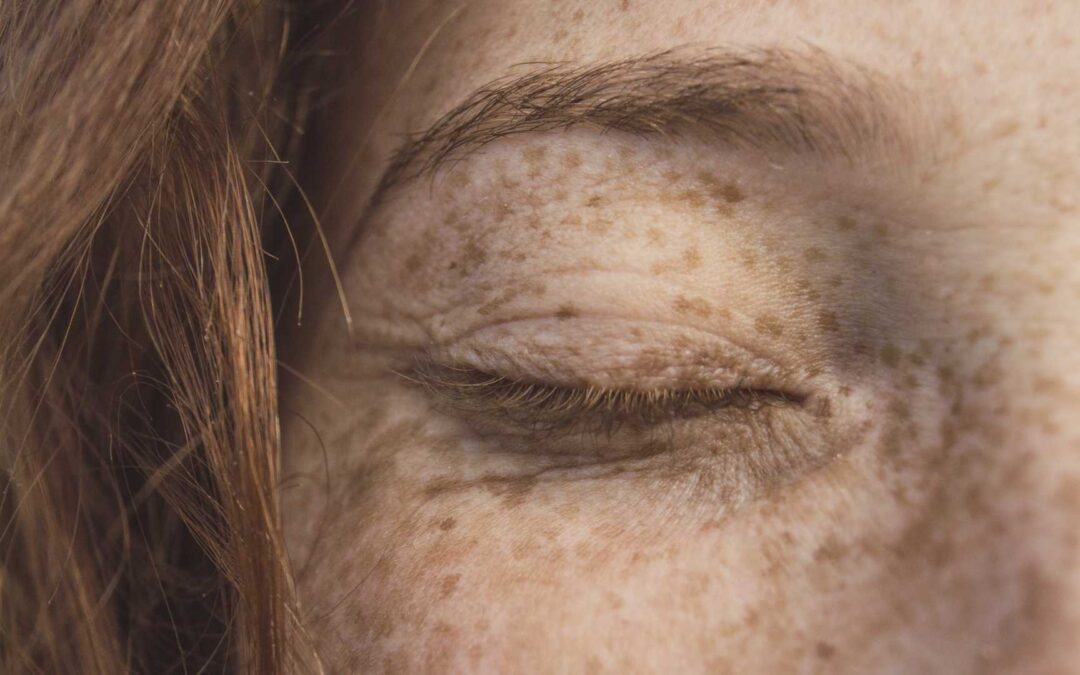 Comment la psychodermatologie explique-t-elle l’influence de l’esprit sur la santé de la peau ?